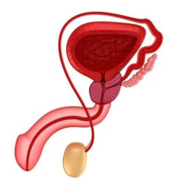 Problémy s prostatou