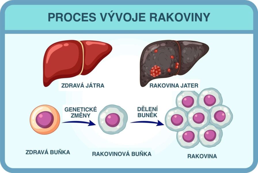 Proces vzniku rakoviny jater