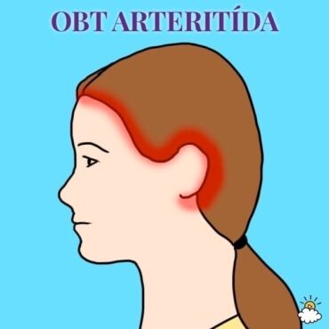 Bolest hlavy obt arteritida