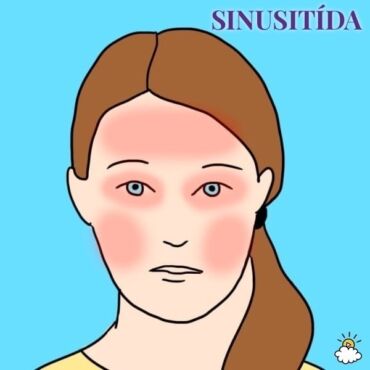 Bolest hlavy sinusitida