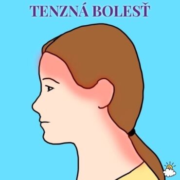 Bolest hlavy tenzna