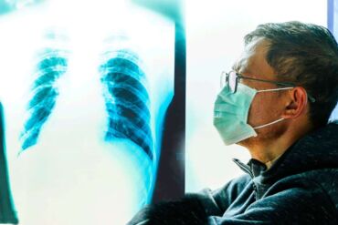 Diagnostika rakoviny plic