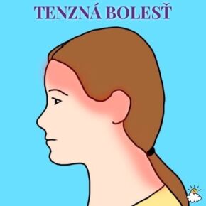 Bolest hlavy tenzna