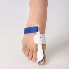 Hallux valgus (vybočený palec) - liečba