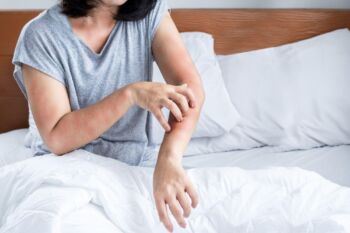 Alergia na roztoče