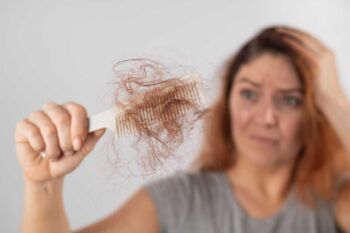 12 přirozených způsobů léčby alopecia areata