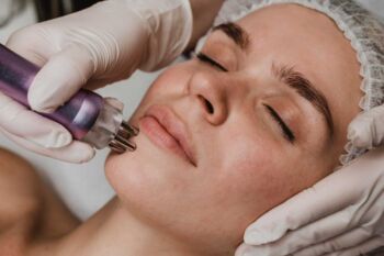Microneedling - 8 účinkov na pokožku