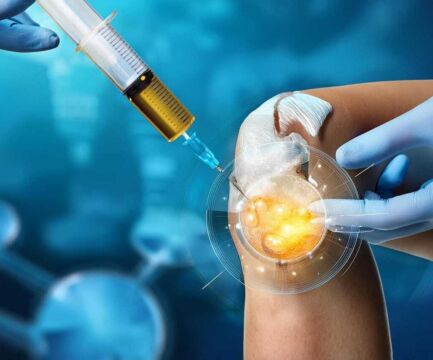 Terapia kmeňovými bunkami: Aké výhody nám ponúka?