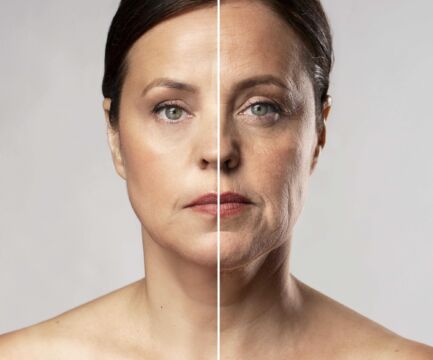 Ako sa zbaviť vrások: 13 tipov na ich redukciu a prevenciu