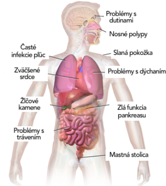 Jak se cystická fibróza projevuje