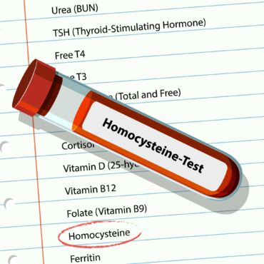 Ako sa meria hladina homocysteínu