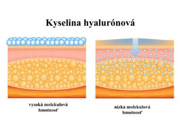 Druhy kyseliny hyaluronové v kosmetice