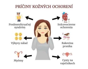 Medzi hlavné príčiny väčšiny kožných ochorení patrí viacero faktorov.