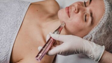 Kyselina ferulová může zvýšit účinnost microneedlingu.